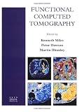 Functional Computed Tomography