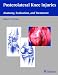 Posterolateral Knee Injuries: Anatomy, Evaluation, and Treatment