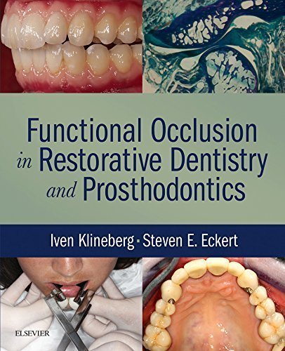 Functional Occlusion in Restorative Dentistry and Prosthodontics, 1e by Iven Klineberg (2015-09-17)