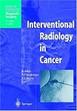 Interventional Radiology in Cancer