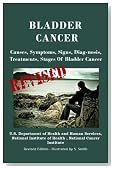 Bladder Cancer: Causes, Symptoms, Signs, Diag-nosis, Treatments, Stages Of Bladder Cancer - Revised Edition - Illustrated by S. Smith