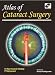Search : Atlas of Cataract Surgery