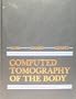 Whole Body Computed Tomography