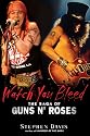 Watch You Bleed