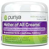 Puriya Cream For Eczema, Psoriasis, Rosacea, Dermatitis, Shingles and Rashes. Powerful 13-in-1 Natural Formula Provides Instant and Lasting Relief For Severely Dry, Cracked, Itchy, or Irritated Skin