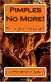 Pimples No More! - The cure for acne