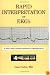 Rapid Interpretation of EKG's, Sixth Edition