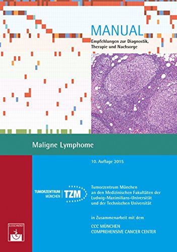 Maligne Lymphome: Empfehlungen zur Diagnostik, Therapie und Nachsorge (Manuale Tumorzentrum München) (German Edition)