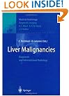 Liver Malignancies: Diagnostic and Interventional Radiology (Medical Radiology / Diagnostic Imaging)
