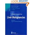 Liver Malignancies: Diagnostic and Interventional Radiology (Medical Radiology / Diagnostic Imaging)