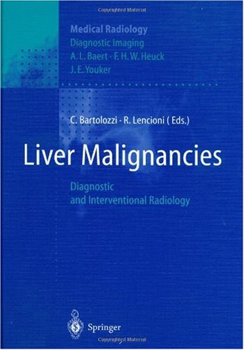 Malignancies
