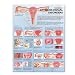 Common Gynecological Disorders Anatomical Chart