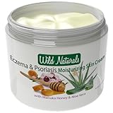 Natural Eczema & Psoriasis Treatment Skin Cream By Wild Naturals - With Manuka Honey and Aloe Vera - For Dermatitis, Acne and Rosacea - Very Light, Non-greasy, Absorbs Quickly - All the Nutrients Your Skin Needs - For All Skin Types - Relieves Dry, Red, Irritated, Itchy, Cracked Skin - Antiviral - Restores Skin's Natural Moisture Balance - Satisfaction Guaranteed