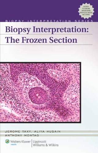 Biopsy Interpretation: The Frozen Section (Biopsy Interpretation Series)