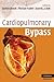 Cardiopulmonary Bypass (Cambridge Clinical Guides)