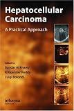 Hepatocellular Carcinoma: A Practical Approach