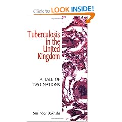 Tuberculosis in the United Kingdom: A Tale of Two Nations