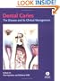 Dental Caries: The Disease and Its Clinical Management