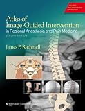 Atlas of image-guided intervention in regional anesthesia and pain medicine