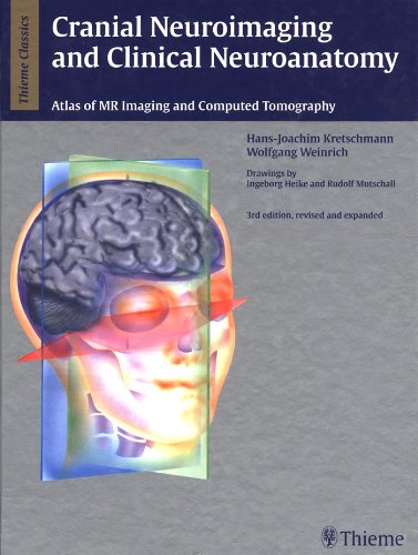 Cranial Neuroimaging and Clinical Neuroanatomy: Magnetic Resonance Imaging and Computed Tomography (Thieme Classics)