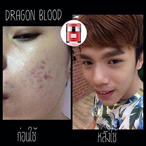 Kimberrey Dragon Blood