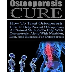 Osteoporosis Cure How To Treat Osteoporosis, How To Help Prevent Osteoporosis, All Natural Methods To Help With Osteoporosis, Along With Nutrition Die
