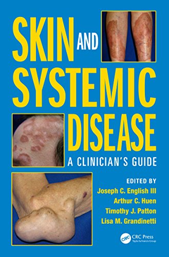 Skin and Systemic Disease: A Clinician's Guide