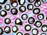 Electron Microscopy of Toothbrush Tips X75 Photographic Poster Print, 16x12