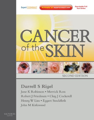 skin cancer