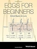 ECGs for beginners