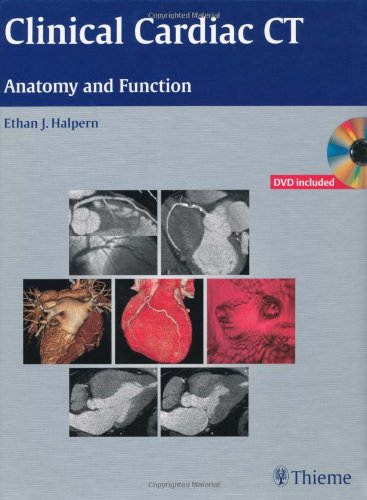 clinical cardiac ct anatomy and function