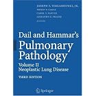 Dail and Hammar's Pulmonary Pathology: Volume 2: Neoplastic Lung Disease by Philip T. Cagle, Jr., and Joseph F. Tomashefski