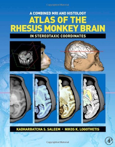 A Combined MRI and Histology Atlas of the Rhesus Monkey Brain in Stereotaxic Coordinates
