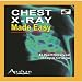 Book Chest X-rays Made Easy