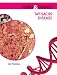 Tay-Sachs Disease (Genes and Disease)