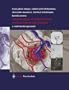 Neurosurgery of Arteriovenous Malformations and Fistulas