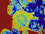 HIV Infected T-Cells AIDS Virus Photographic Poster Print, 32x24