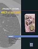 High-resolution CT of the lung