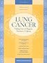 Lung Cancer: Making Sense of Diagnosis, Treatment, and Options (Patient-Centered Guides)