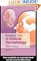Botulinum Toxin in Clinical Dermatology