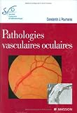 Pathologies vasculaires oculaires