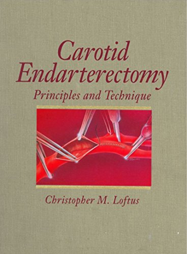 Carotid Endarterectomy: Principles and Technique
