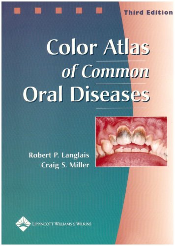 Color Atlas of Common Oral Diseases