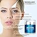 Retinol Cream Moisturizer for Face with Hyaluronic Acid, Shea Butter & Jojoba Oil - Enhanced Anti Wrinkle Anti Aging Skin Care Formula - Reduces Fine Lines, Age Spots - BEST Night & Day Cream 1.7 Oz