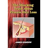 The Shocking Truth About Female Hair Loss