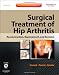 osteoarthritis32 - Surgical Treatment of Hip Arthritis Reconstruction Replacement and