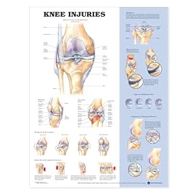 Knee Injuries Anatomical Chart Laminated
