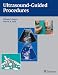 Ultrasound-Guided Procedures