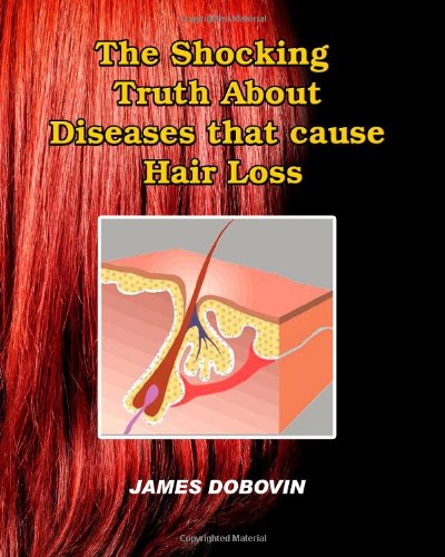 hair loss causes