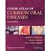 Color Atlas of Common Oral Diseases